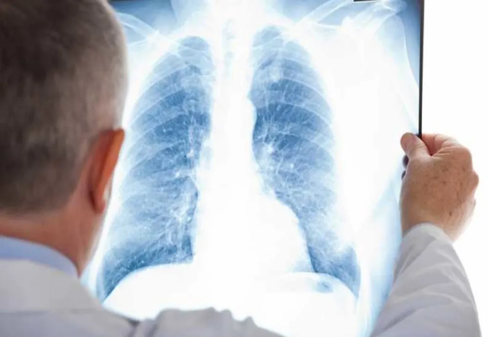 Dosar penal pentru o femeie, după ce a mers să-și facă o radiografie
