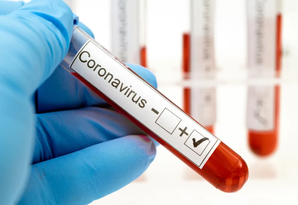 România atinge un nou record de noi cazuri de infectări cu coronavirus