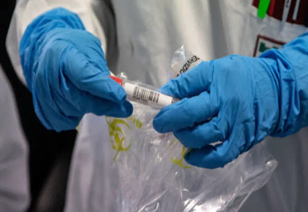 45 de noi cazuri de coronavirus, în județul Timiș. Din ce localități sunt cei care s-au îmbolnăvit