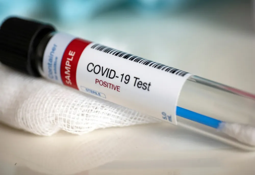 COVID-19. 4.041 de infectări la 10.566 de teste, la nivel național. Situația cazurilor noi, pe județe