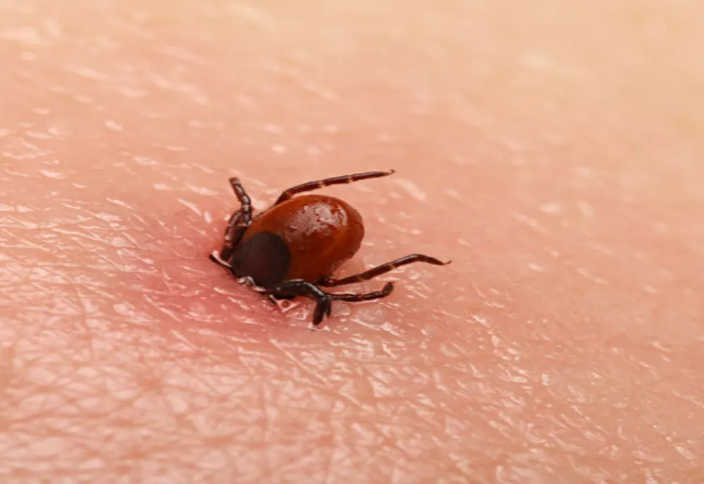 COȘMARUL care a început cu o mușcătură de căpușă: Mărturii EMOȚIONATE ale româncei care suferă de boala Lyme
