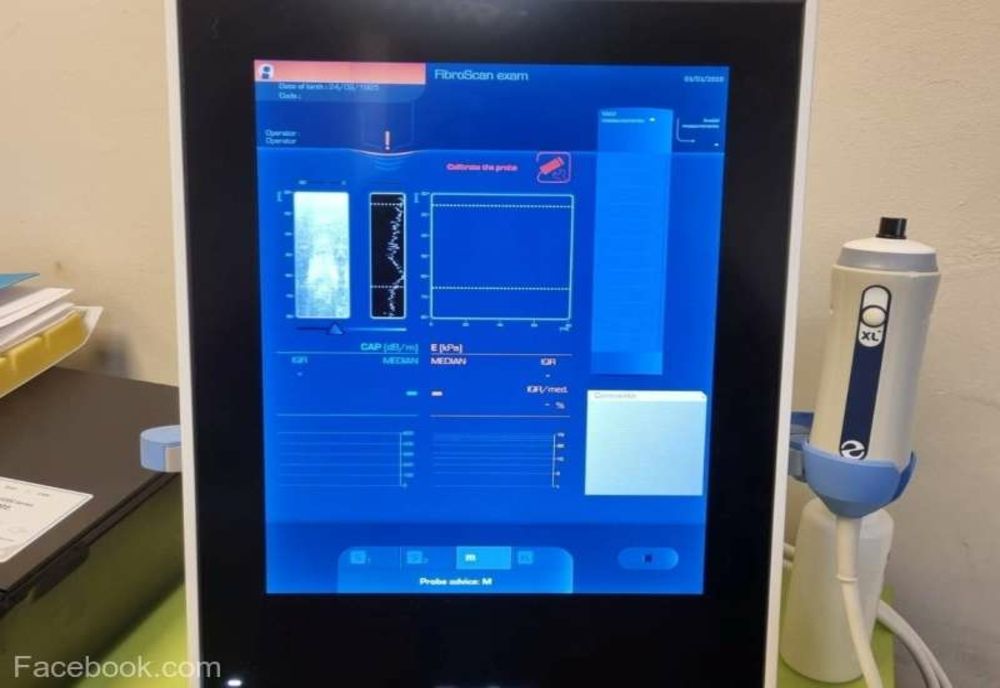 Timiş: Spitalul ''Victor Babeş'' s-a dotat cu un FibroScan ce înlocuieşte biopsia hepatică cu o investigaţie nedureroasă