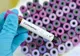 Focar de coronavirus într-o cunoscută cofetărie din Timișoara