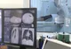 Spitalul de Boli Infecțioase  Victor Babeș nu mai poate realiza investigații imagistice de tip CT persoanelor infectate cu SARS Cov 2